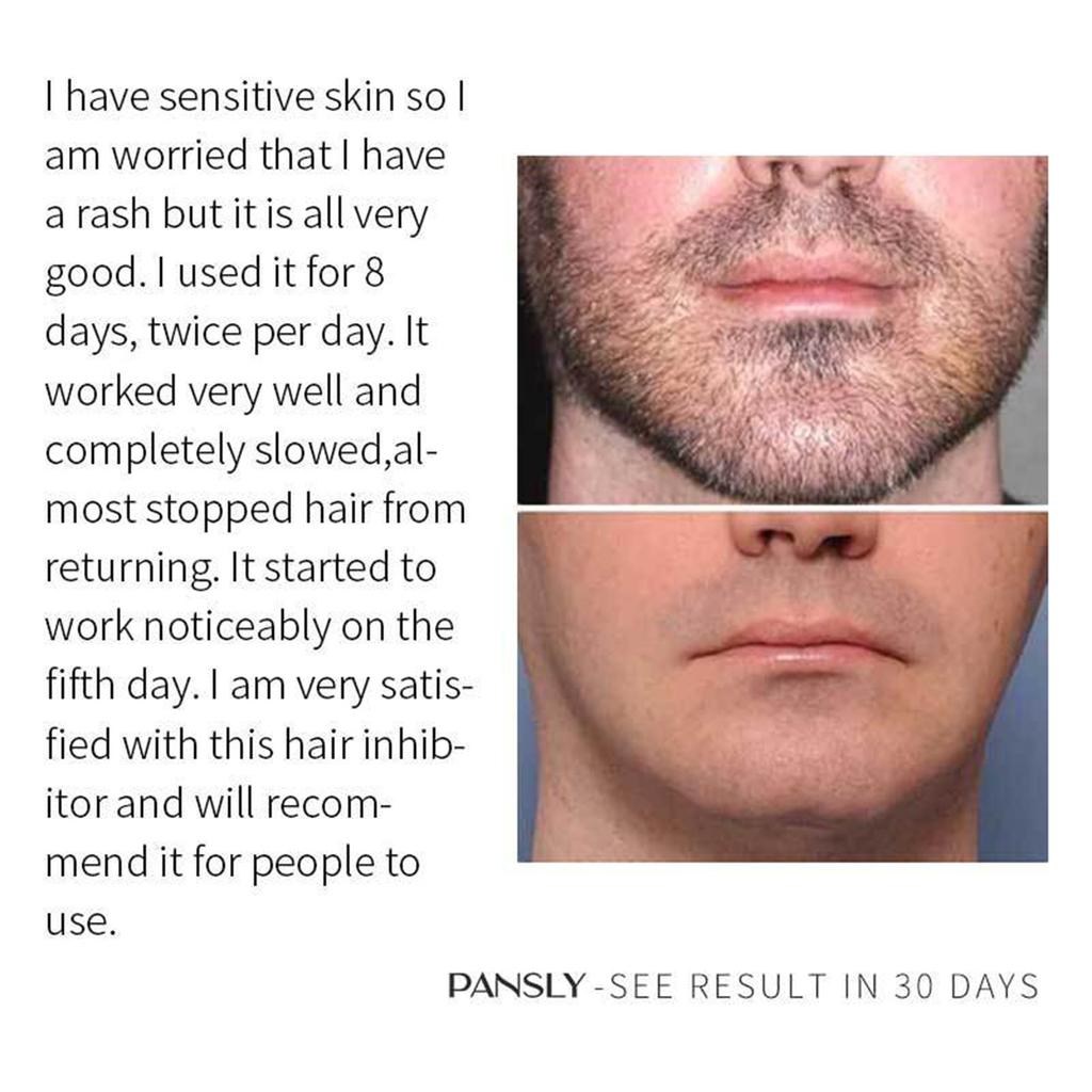 Паста для постоянного удаления волос, средство для удаления волос на лице, депилятор для бороды, подмышек, стойкое подавление роста волос на теле