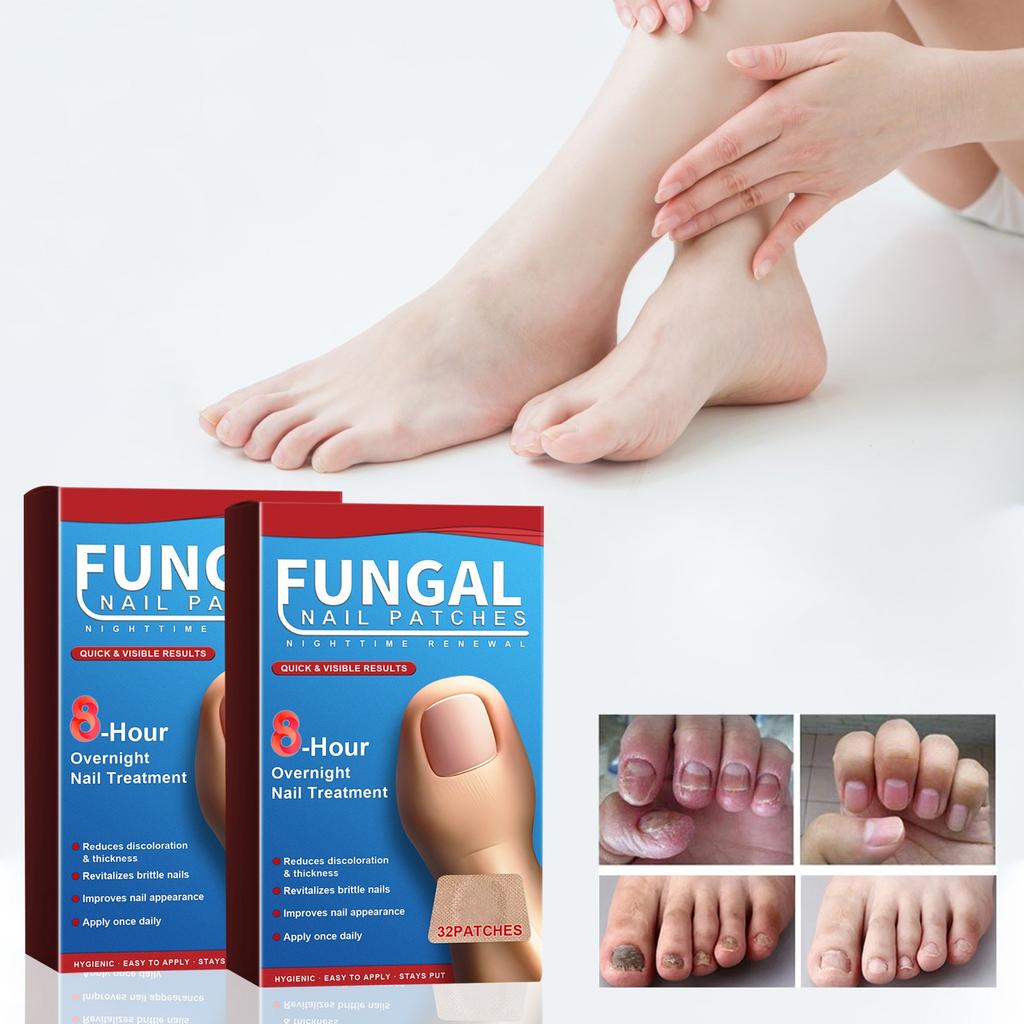 Пластыри для ухода за ночными ногтями Пластыри для ухода за ногтями Пластыри для ухода за утолщенными ногтями Вросшие ногти и мягкие ногти Пластыри для ухода за ногтями