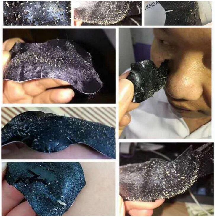 10/20/30/50 шт., бамбуковый уголь, маска для удаления угрей, пятен, прыщей, маска для лечения прыщей, наклейка на нос, очиститель пор, глубокая чистая полоска