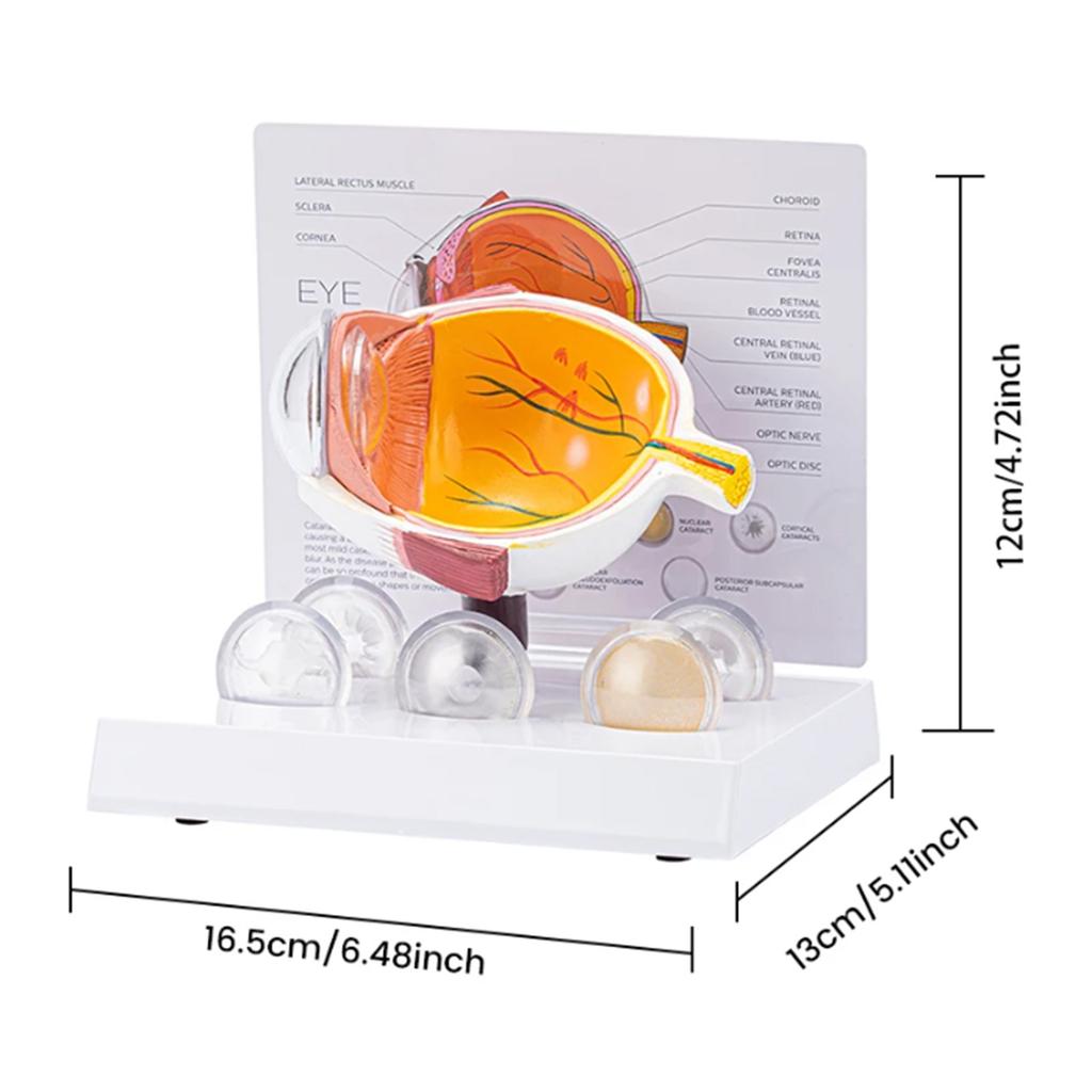 Модель анатомии человеческого глаза Анатомическая патологическая модель глазного яблока Обучающее пособие Реалистичная патологическая модель анатомии глазного яблока