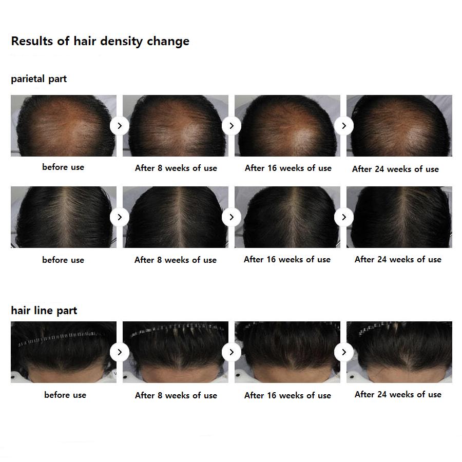 Дерматологический шампунь от выпадения волос Lador (для средних / сухих)