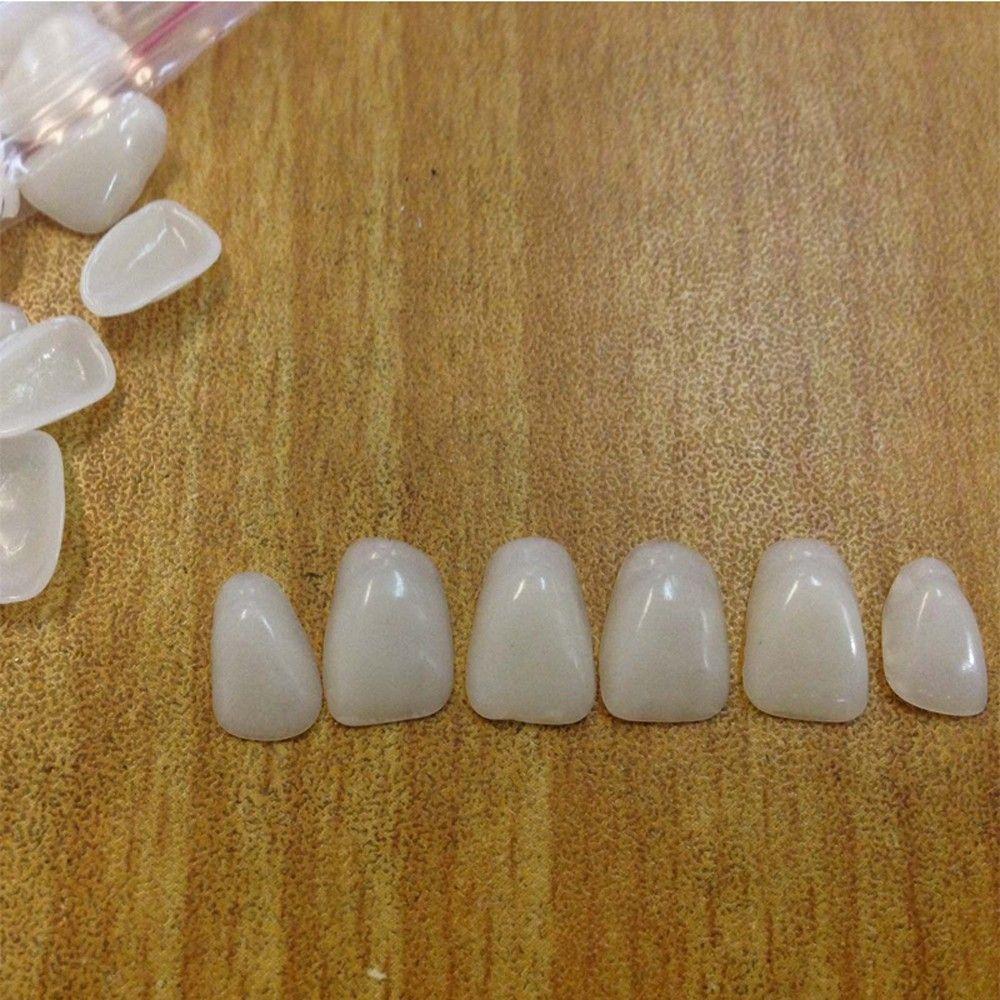 Beauty Veneers Ultra-Thin Whitening Upper Anterior Resin Teeth Dental Films Porcelain Teeth