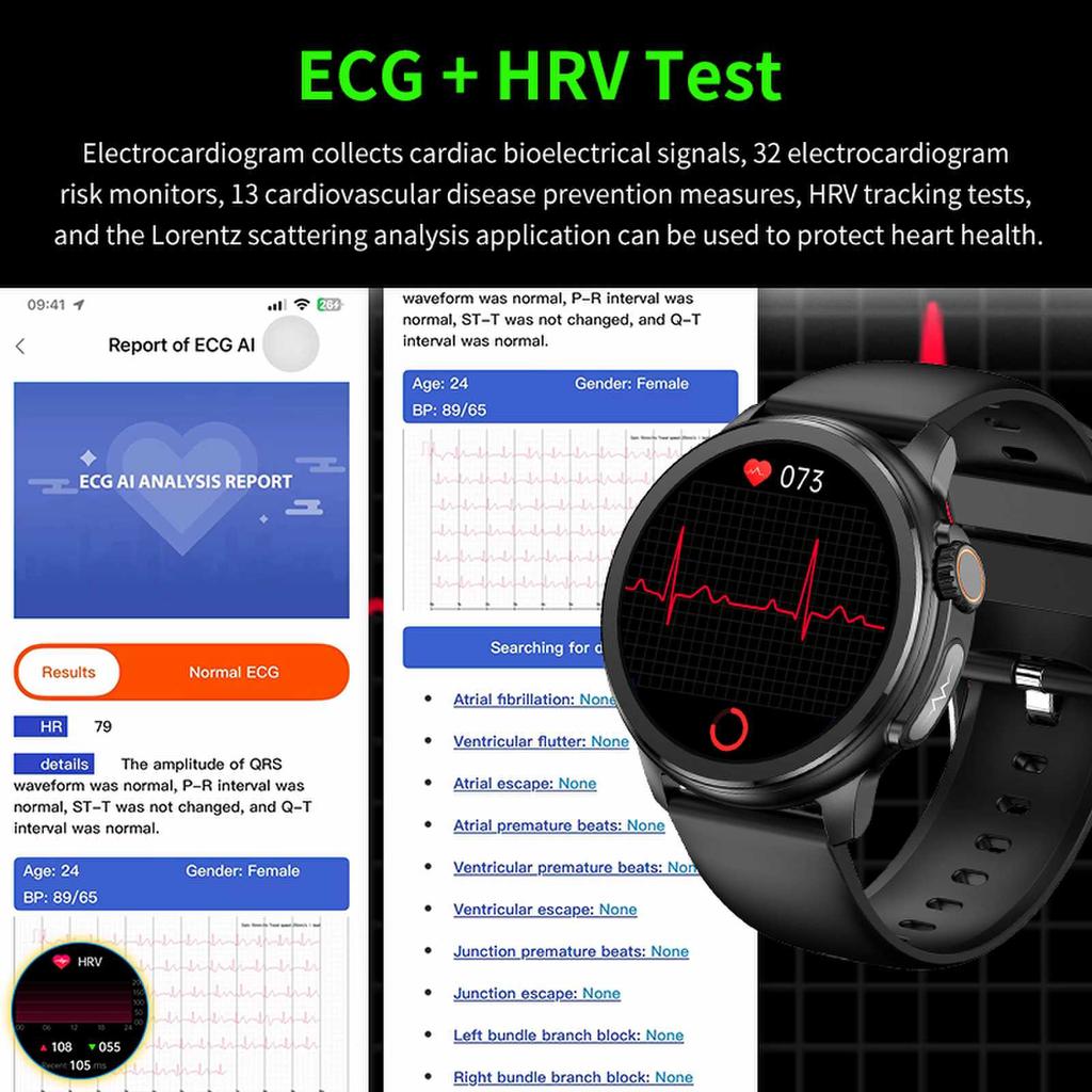 SACOSDING 1,43-дюймовый HD-экран, Bluetooth-вызов, ЭКГ, умные часы для мужчин и женщин, кровяное давление, кислород, частота сердечных сокращений, трекер упражнений, ET481