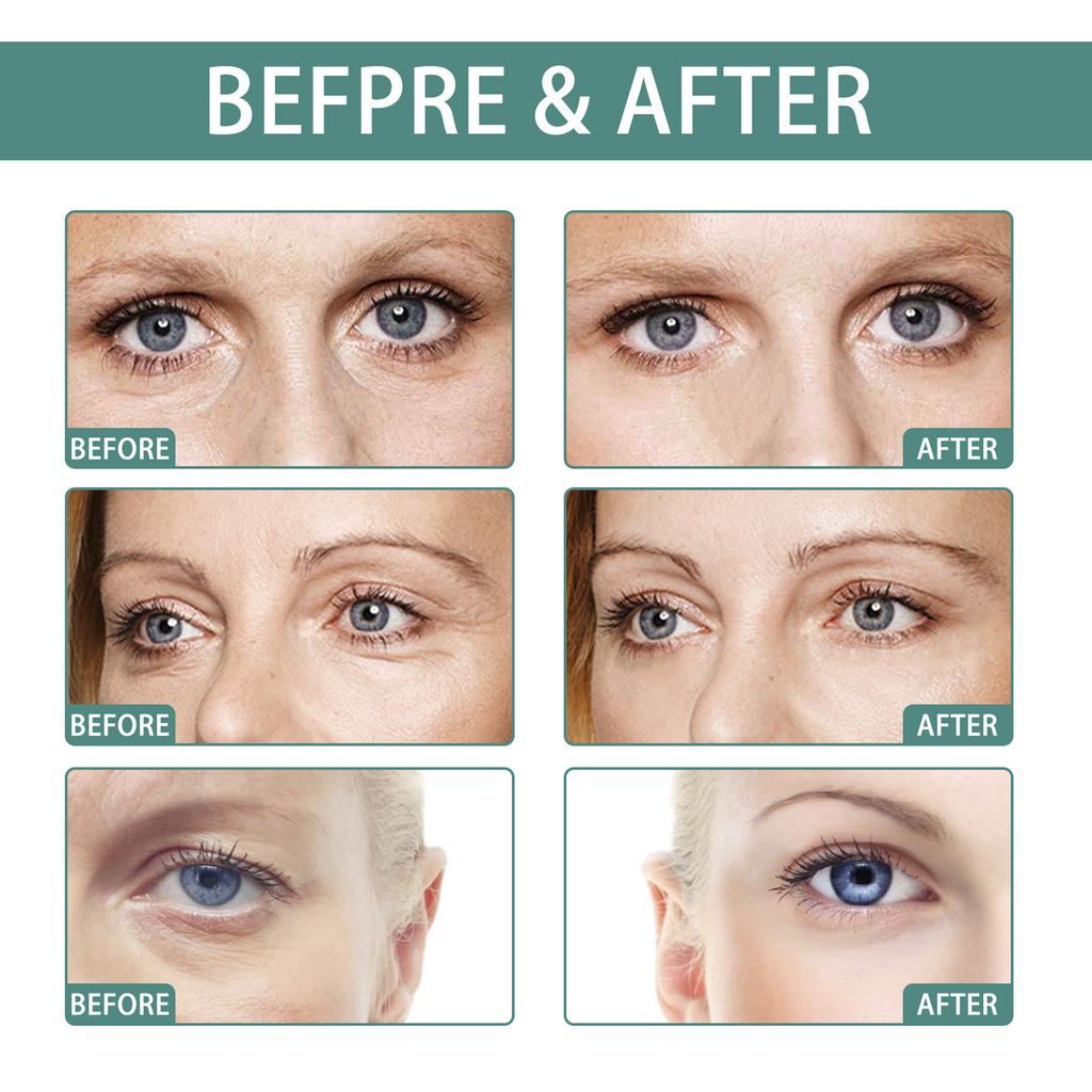 Крем для кожи вокруг глаз против морщин EELHOE Уход за кожей вокруг глаз Уменьшает появление темных пятен Сухие морщины Мелкие морщины Укрепление и восстановление