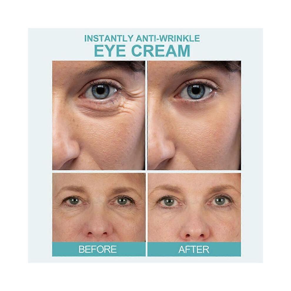 15pcs Instantly Eyes Dark Circle Cream 5pcs/set Anti-Aging Under Eye Cream Remove Eye Bags Puffiness Lift Plump Firm Tighten Eyes Skin