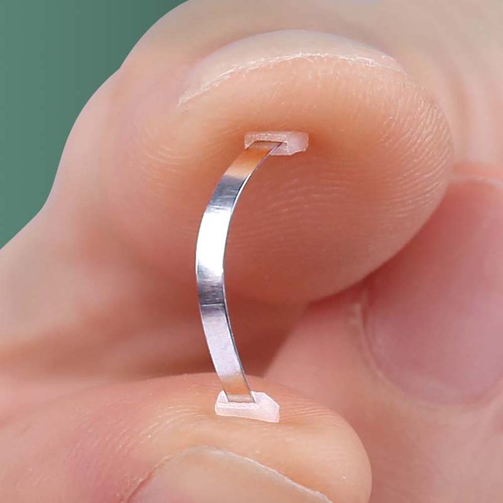 Pedicure Tool Ingrown Toenails Corrector Toenail Fixer Bunion Corrector Toenail Straightener