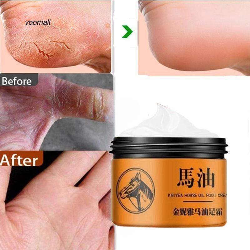 Крем для восстановления рук и ног с лошадиным маслом. Крем для ухода за ногами. Крем для ухода за бери-бери и зудом на ногах.
