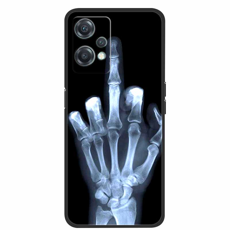 For OnePlus Nord CE 2 Lite 5G Cases CE2 CE3 Lite N20 Soft TPU Silicone Back Cover for One Plus Nord 3 Coque Fundas CE2 Lite
