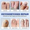 2025 Fungus Patch Waterproof Nail Repair Patches, Ingrown Nail Correction Stickers, 1/2/3/4/5pcs for Discolored or Damaged Nails
