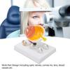 Eyeball Lesion Model Enlarged Human Eye Anatomical Model Accurate Shows Optic Cornea Lens Eyeball Model