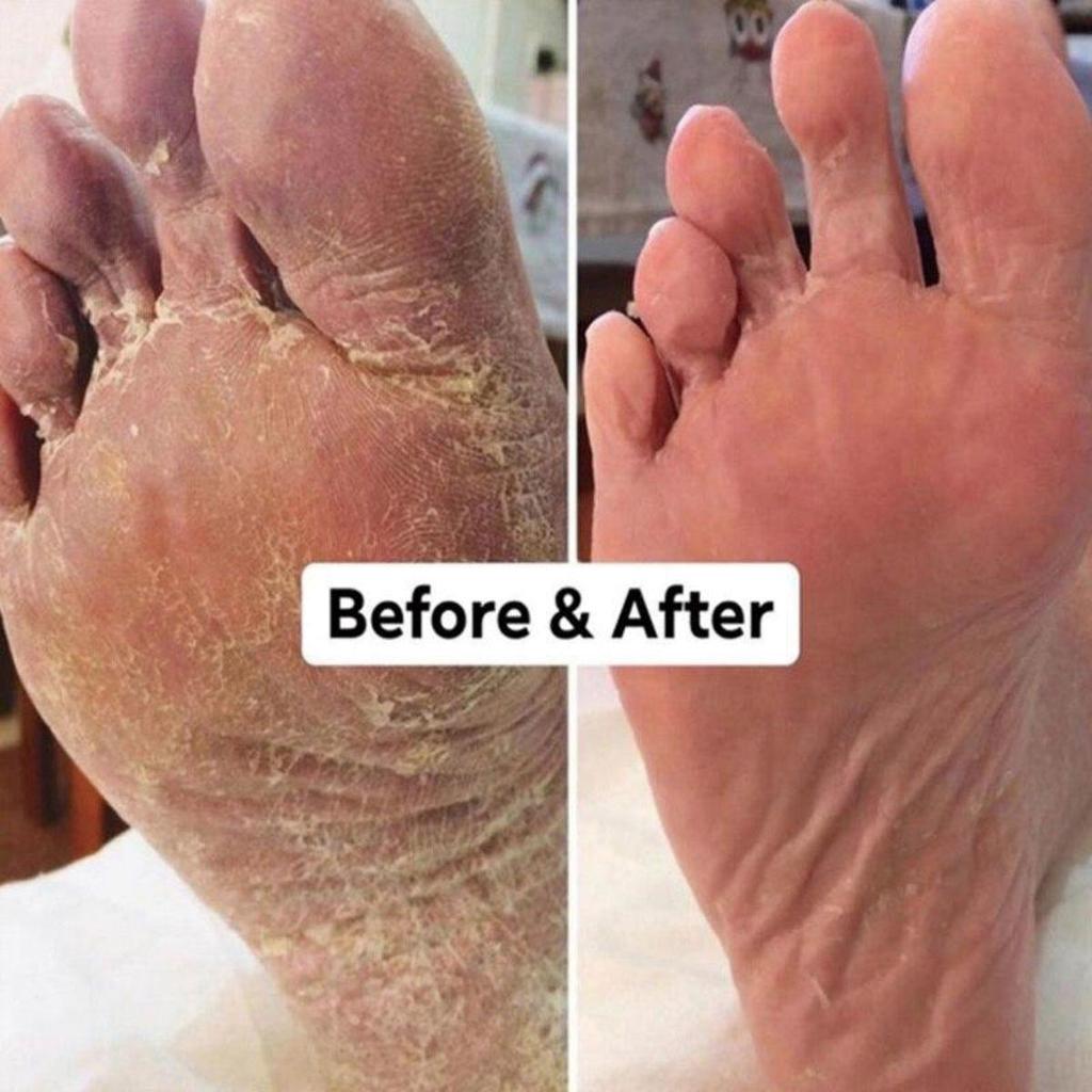 Крем для восстановления потрескавшихся рук и ног, увлажняет, питает кожу, делает ее мягкой и нежной.