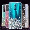 Glitter Star Bling Case For Xiaomi Redmi Note 9S 8 Pro 7 6 8T 8A 7A K30 K20 Soft Silicone TPU Cover For Xiaomi Mi 10 Pro CC9 9T 9 8 Lite SE Cases