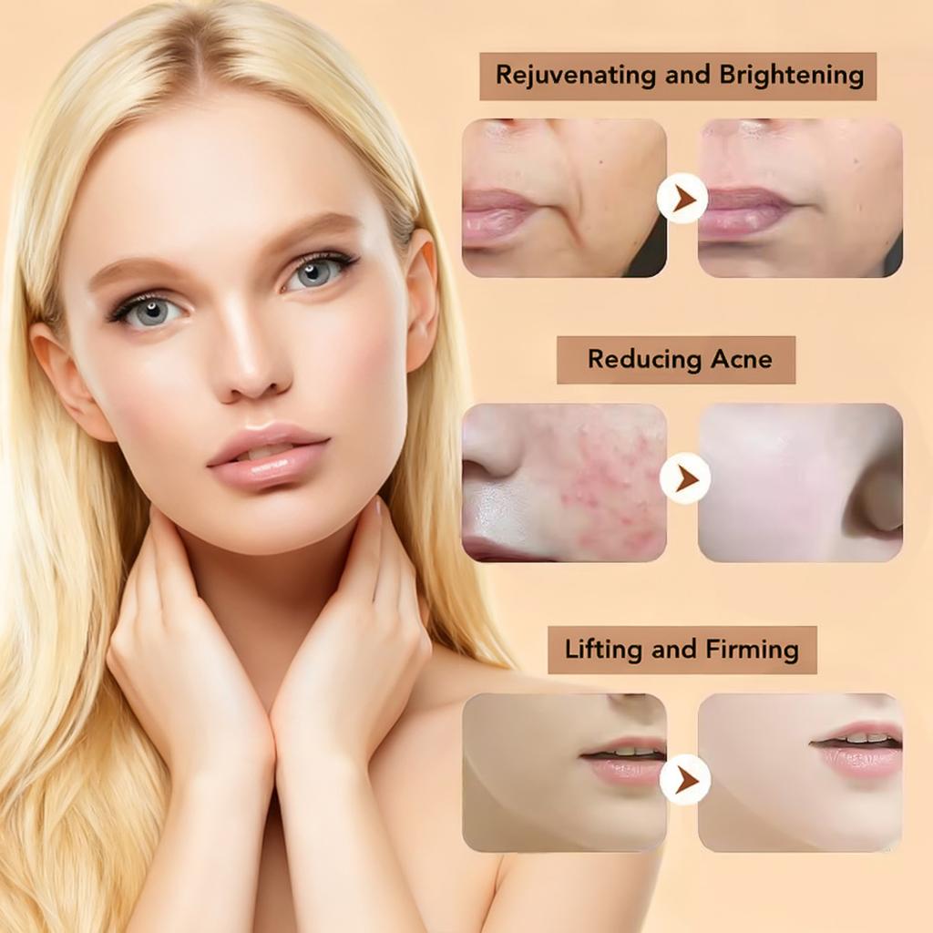 Высококачественный экстрактор черных точек из нержавеющей стали