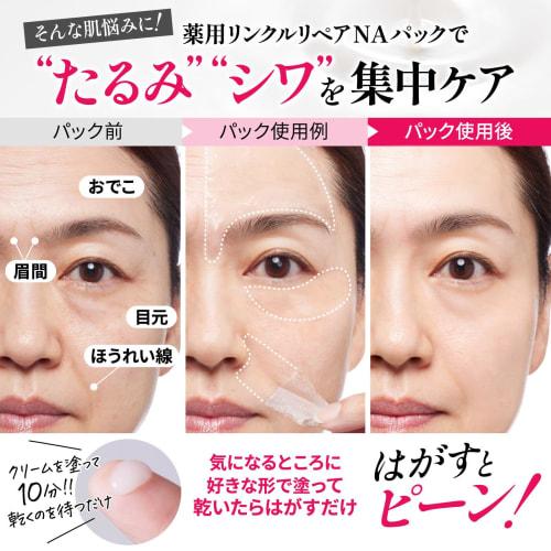 Лекарственный набор для улучшения морщин носогубные складки межбровные морщины провисание лба ниацинамид ретинол морщины ремонт na 30g