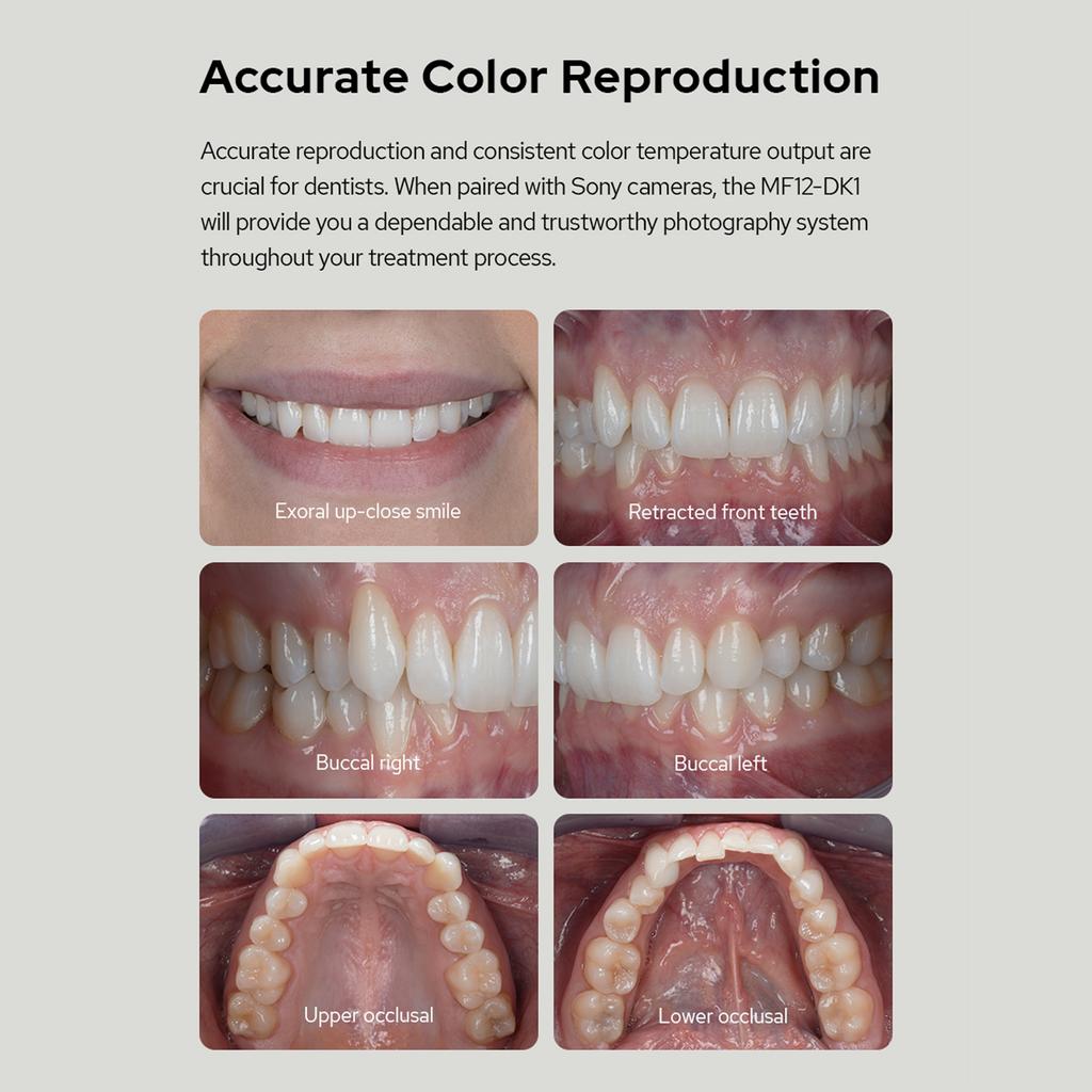 Комплект макровспышки GODOX MF12-DK1, включающий 2 выносные TTL-вспышки MF12 + 1 триггер вспышки + 8