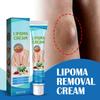 Lipoma Ointment, Lipoma Removal Paste, Natural Herbal Lipoma Lump Removal Paste, Lipoma Removal Paste Ointment