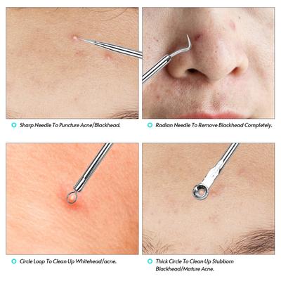 Набор инструментов для удаления черных точек, прыщей, поппера, прыщей, пятен, комедонов, прыщей, прыщей, белых угрей, лица, подбородка