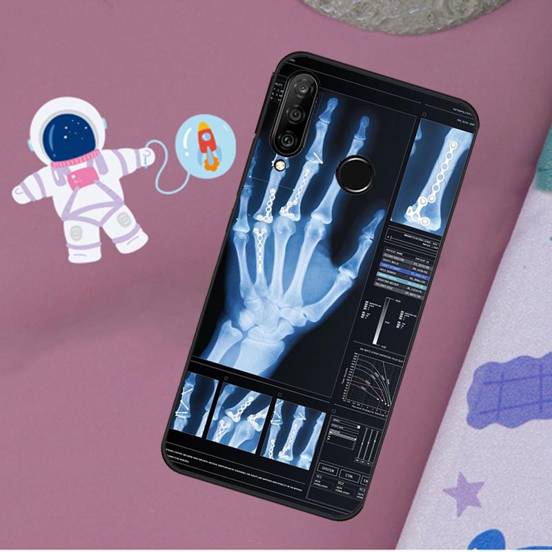 Радиологический Скелет Человеческих Органов Для Huawei Nova 12s 12i 11i 8i Y73 Y72 Y61 Y91 Y90 Y70 Y60 9 10 SE P30 P40 Lite P60 Pro Чехол