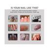 3x Efero Nail Exfoliation Plant Nail Repair Fluid Nail Cream Nail Treatment Gel Nail Repair Gel Moisturizing Nail Luster Tw