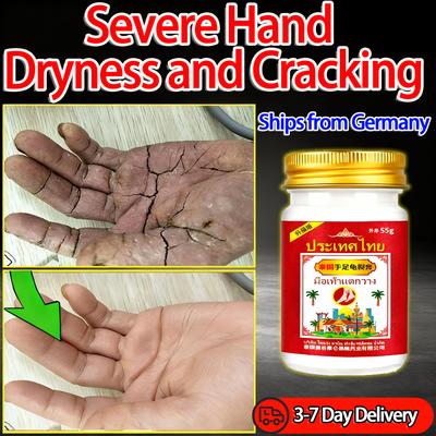 Специальная мазь для сильной сухости и трещин рук, глубоко увлажняющая и против трещин