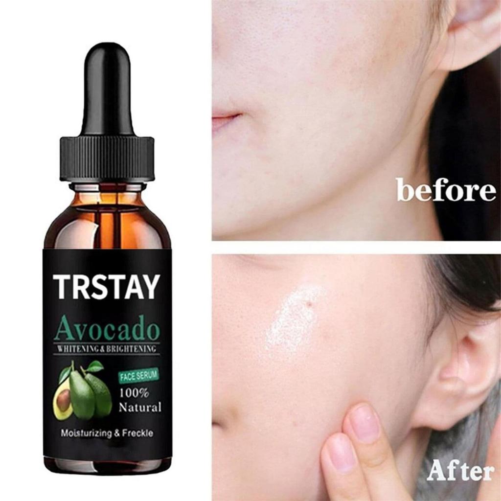 5ML/15ML/30ML/50ML/TRSTAY Dark Spot Serum Hyaluronic Acid Whitening Vitamin C, Face Serum Turmeric Collagen, Facial Skin Care Beauty