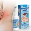 Heat Rash Spray, Quick Relief Of Itching 30ml