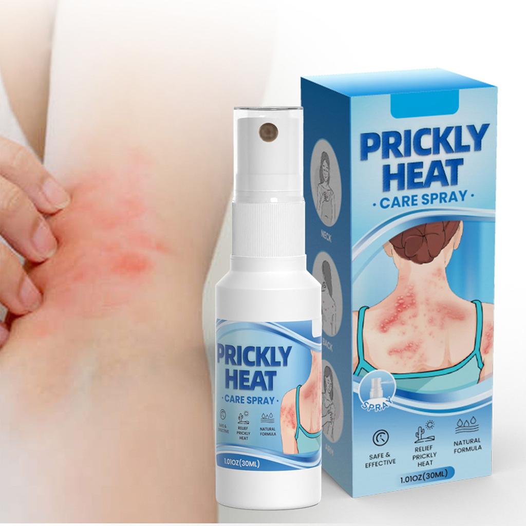 Heat Rash Spray, Quick Relief Of Itching 30ml