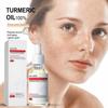 Куркума Веснушки Отбеливающая Сыворотка Удаление Темных Пятен Корректирующая Эссенция Уход Красота Пигмент W1K0