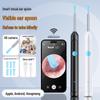 Wireless HD WiFi Smart Ear Cleaning Tool with Visual Spoon