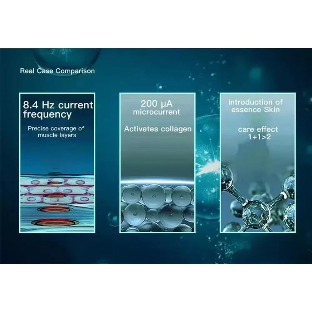 Ozone Cold Plasma Pen Acne Removal Sensitive Skin Anti Wrinkle Blue Light Deep Acne Cleaner Eliminating Acne Shrink Pores Beauty