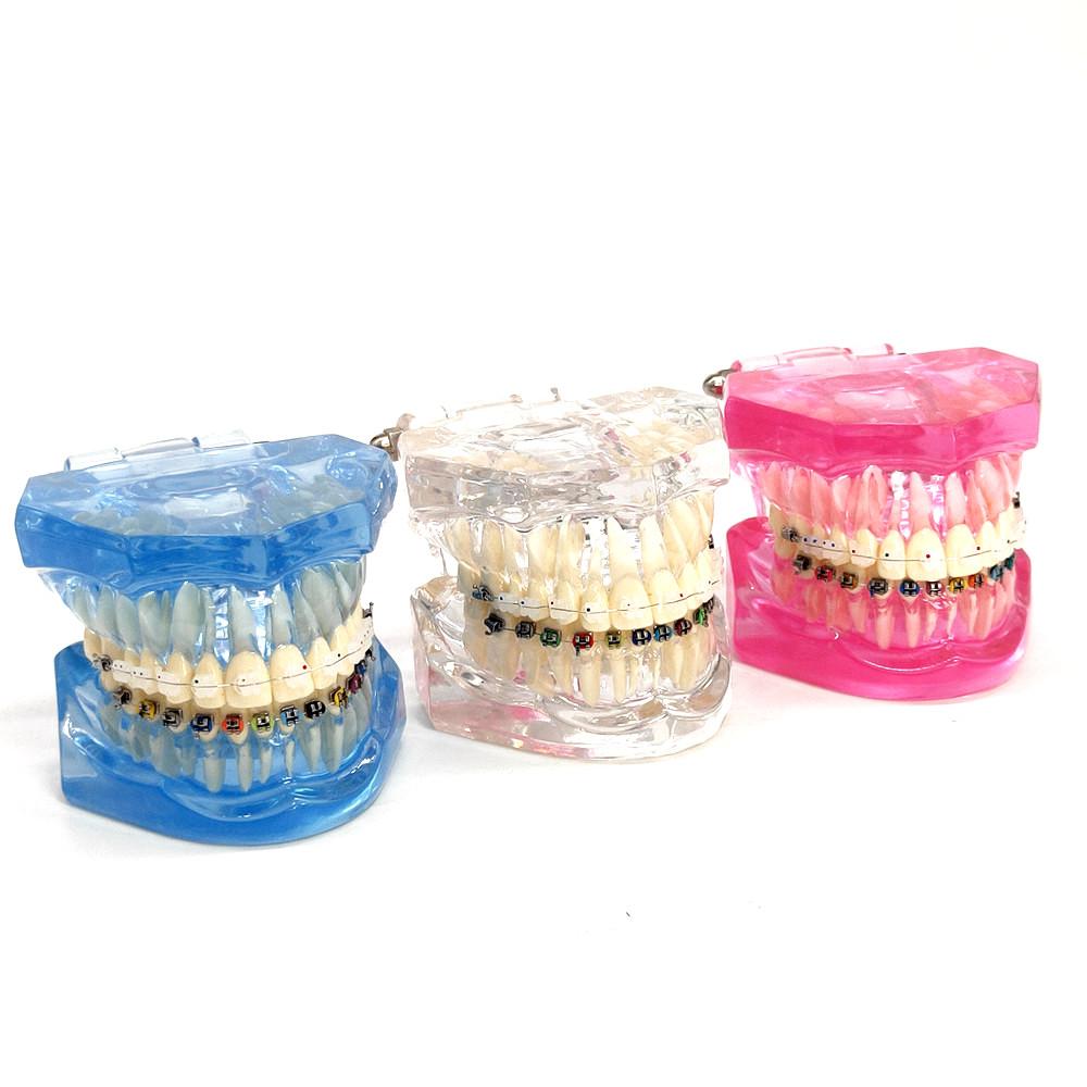 1 шт., стоматологическая ортодонтическая модель, связь с пациентом, 2 вида брекетов с дугами, лигатуры, керамический брекет, металлический краевой брекет