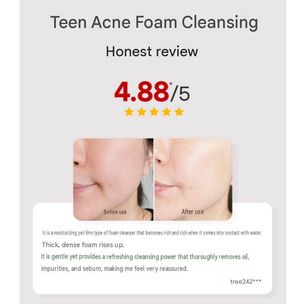 Waf Lab Tea Teen Acne Foam Cleansing 150ml/5.07fl.oz.