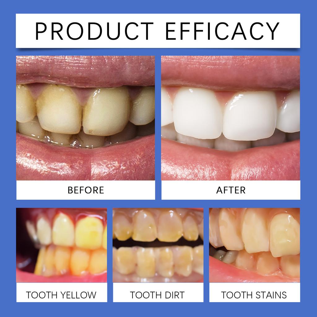 Порошок для удаления пятен и отбеливания зубов, Очищающий зубной порошок, Освежает дыхание, Отбеливает и очищает.