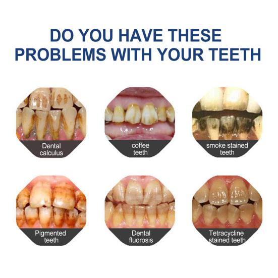 1/2Pcs 100G Whitening Toothpaste Freshening Breath Stain Removal Oral Health Enamel Protection Sensitive Teeth Cleaning Brightening Toothpaste