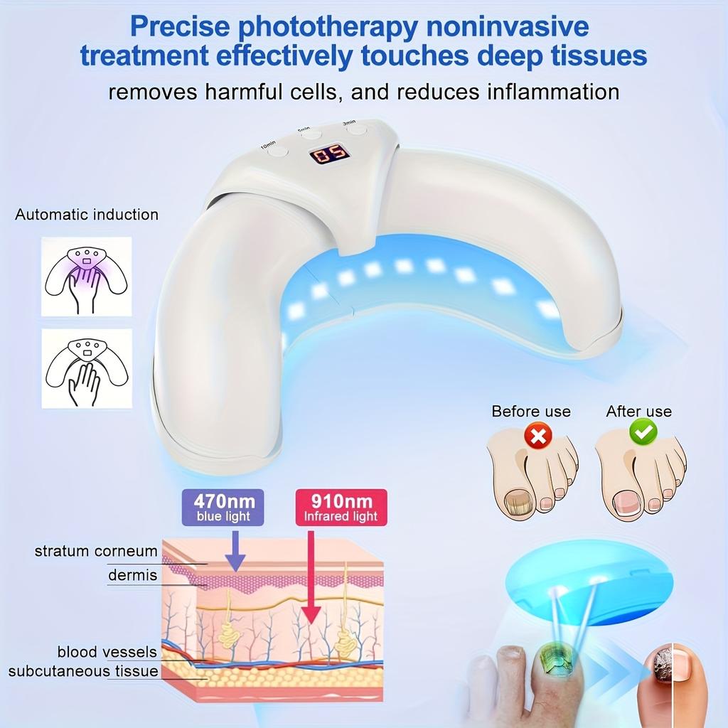 Лазерный стерилизатор для ногтей, в 2 раза более быстрое удаление и восстановление плесени, специально для ногтей с несколькими пальцами, складное оборудование для очистки от плесени