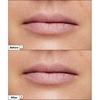 Dr.jart Vital Hydra Solution Увлажняющая маска для губ 20 г