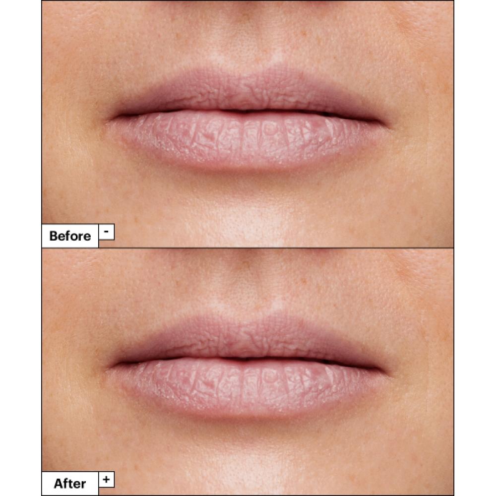 Dr.jart Vital Hydra Solution Увлажняющая маска для губ 20 г