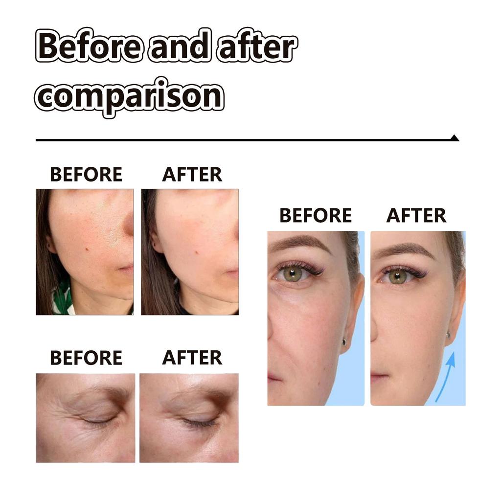 EELHOE Крем для лица Крем для лица с ретинолом Удаление темных пятен Отбеливание Уход за лицом Увлажняющий антивозрастной укрепляющий уход за кожей Косметика 100 мл