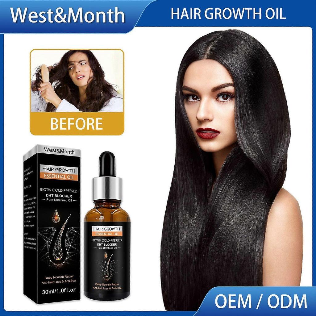 West&Month Hair Growth Essential Oil, Dense Hair Growth Repair Dry Hair And Moisture Hair Essence