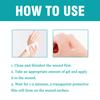 Wound, Wound Suture Glue, Isolate And Keep Dry 10ml