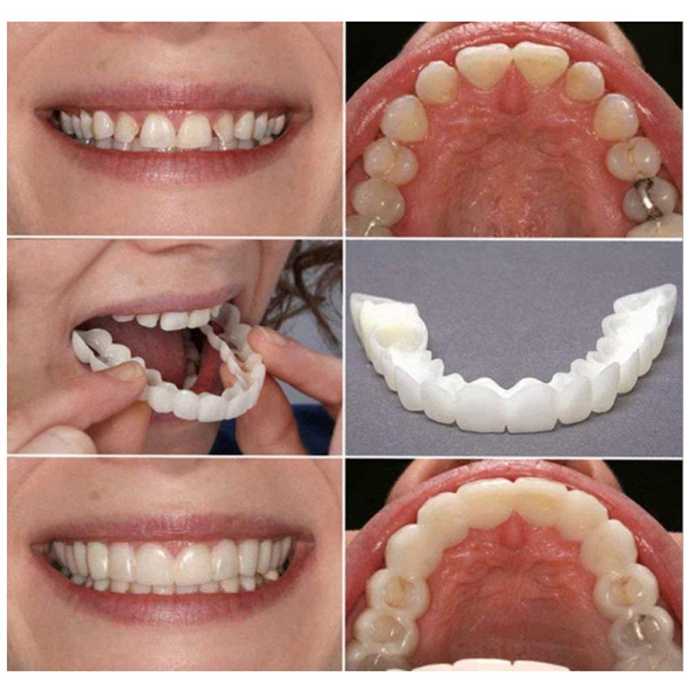 Perfect Fit Teeth Whitening Fake Tooth Cover Snap Cap Silicone Upper/Lower Jaw Denture False Teeth Veneer Regain Confident Smile