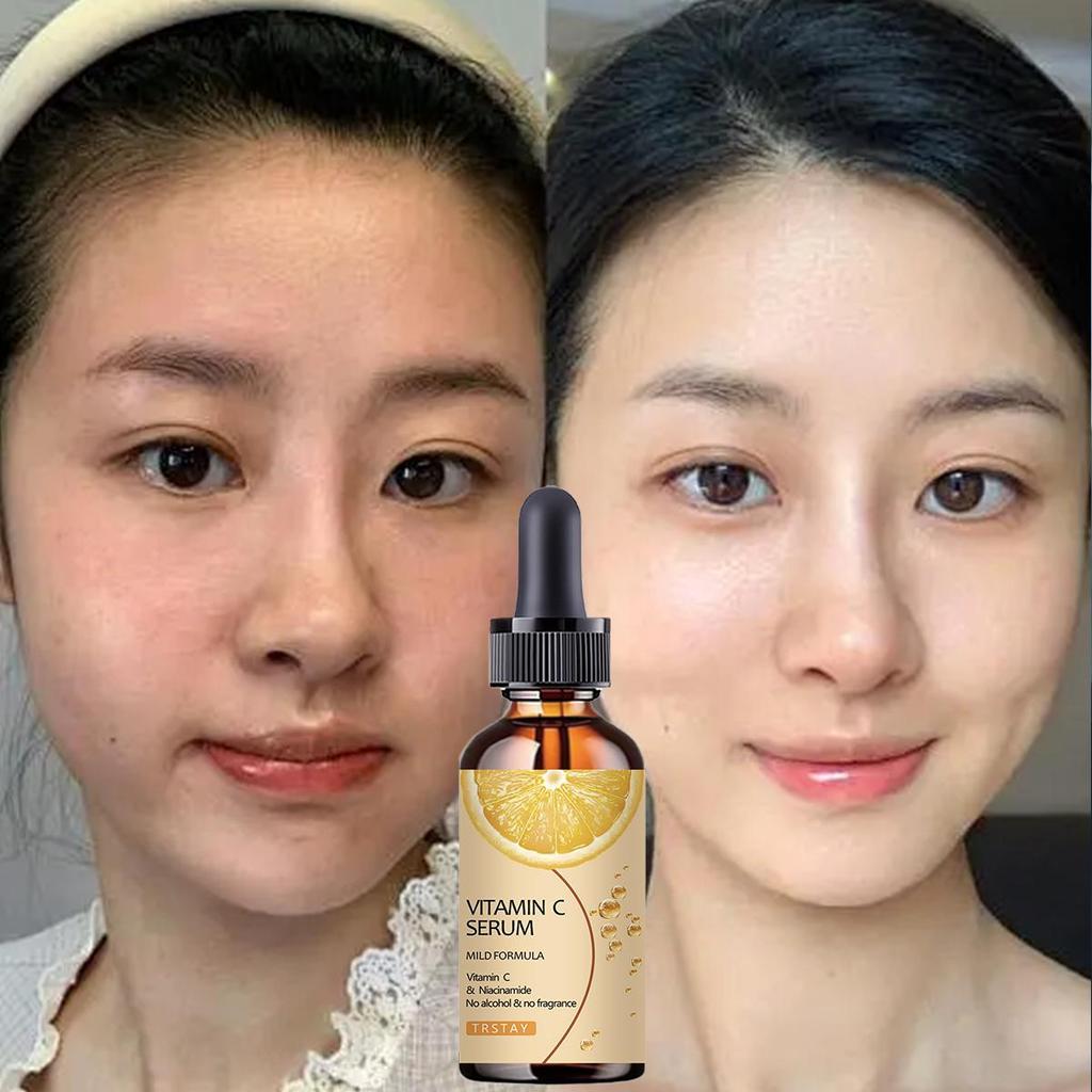 TRSTAY Facial Essence Use Vitamin C Pigment To Remove Black Spots, Whiten Facial Essence, Whiten Skin Care Products, Beauty and Health Care