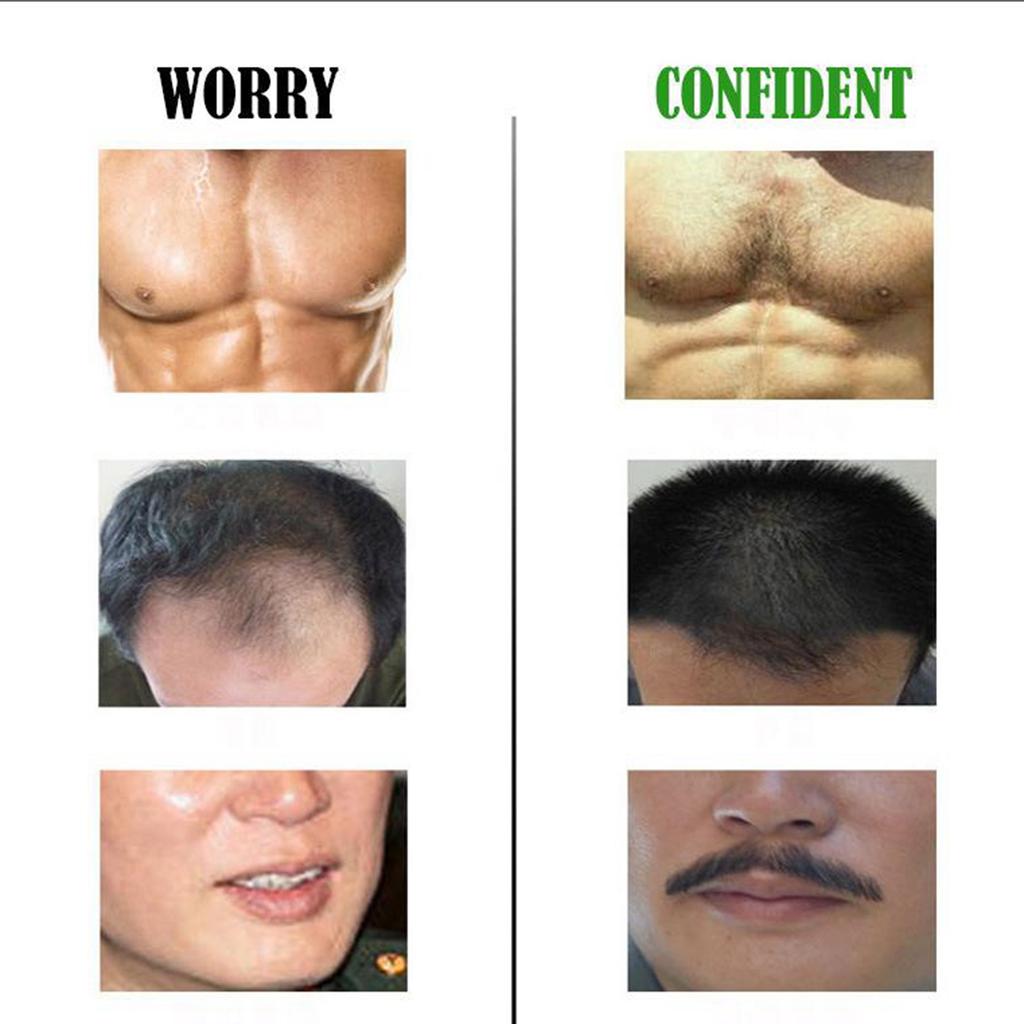 Beard Growth Oil Serum Fast Growing Mustache Facial Hair Grooming 30ml