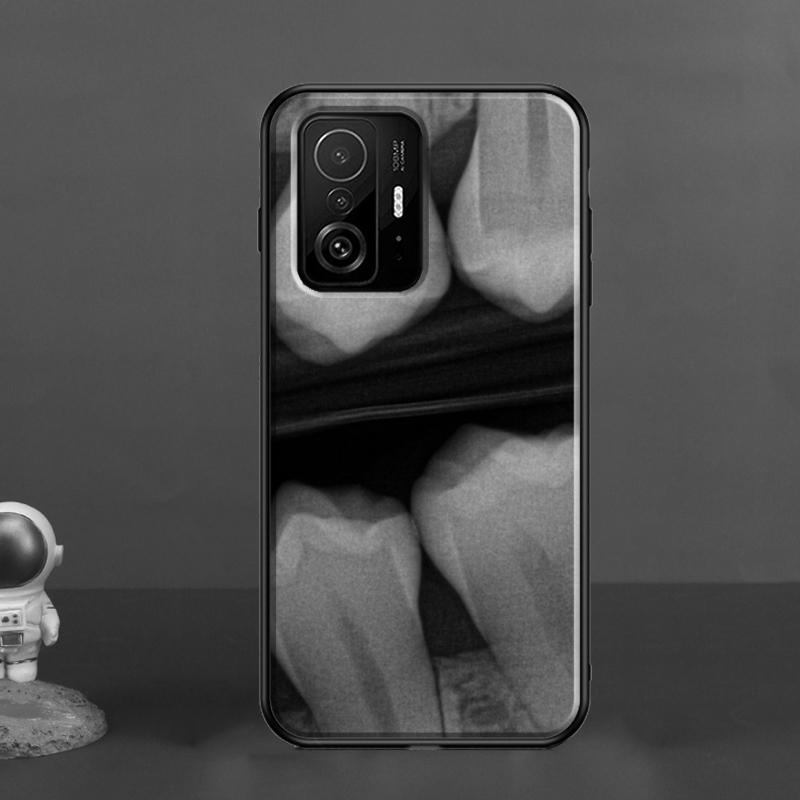 Чехол с рисунком зуба стоматолога для POCO X5 X3 F5 Pro X4 F4 GT M5s C40 F3 для Xiaomi 13 Lite 12 11T 12T Pro 12X