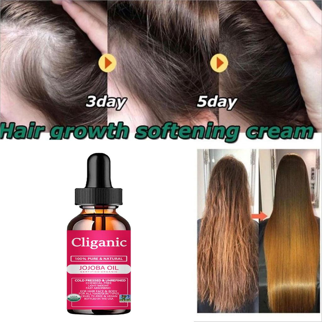 Сыворотка для роста волос, масло, быстрый густой натуральный уход за волосами, восстановление кожи головы, предотвращение выпадения волос, средства для восстановления поврежденных волос