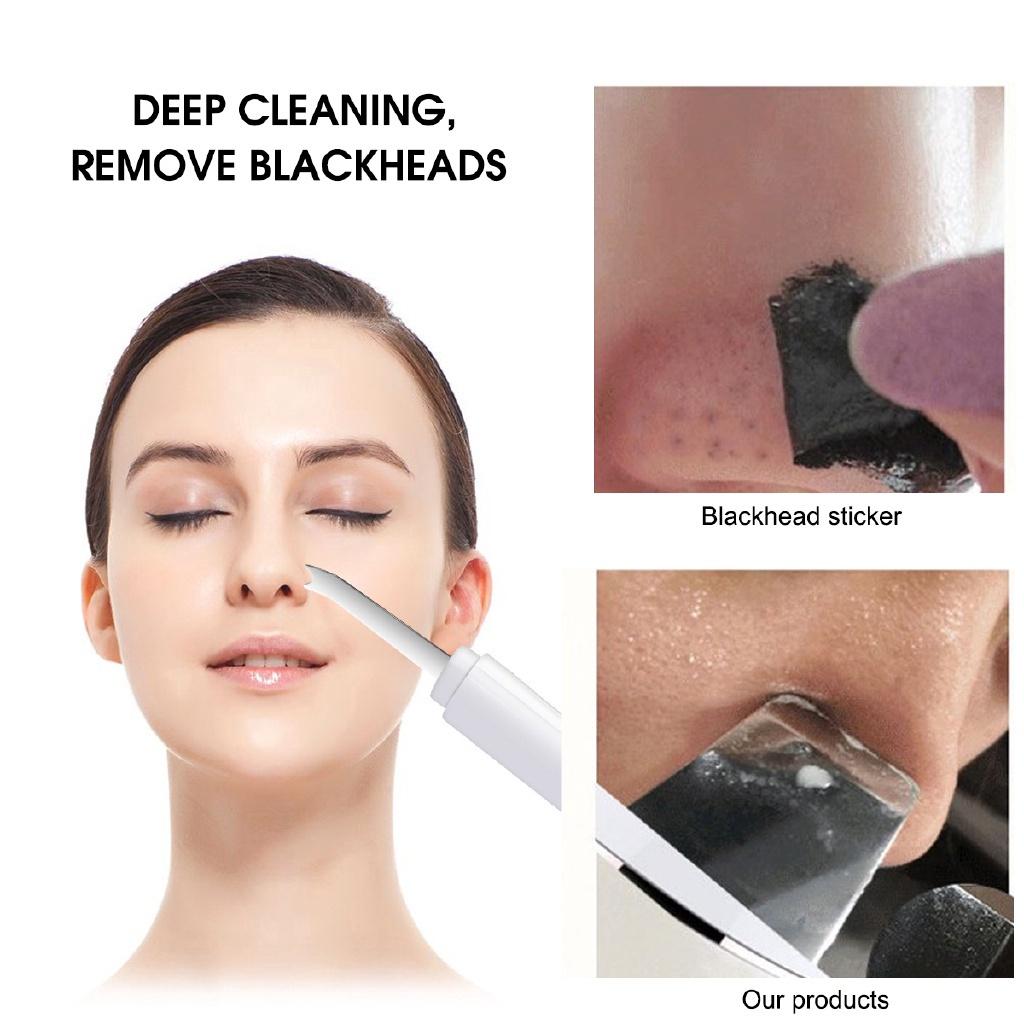 Sucking Out Blackhead Facial Pore Facial Blackhead Remover Vacuum Dead Skin Acne Pore Peeling Device Cleaning Skin Tool
