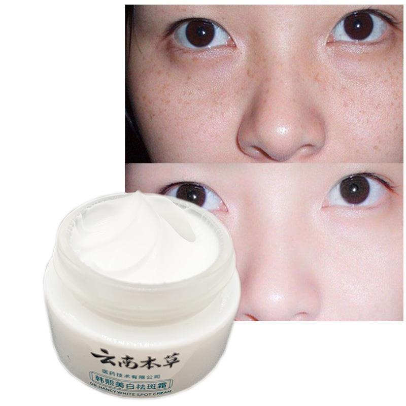 Крем для проблемной кожи Pure Skin Anti Aging Cream Увлажнение Веснушки Акне Удаление темных пятен Уход за кожей Отбеливание