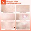 MeiYanQiong Centella Acne Patch Stickers Acne Treatment Pimple Remover Tool Blemish Spot Facial Mask Skin Care Waterproof 24 Patches