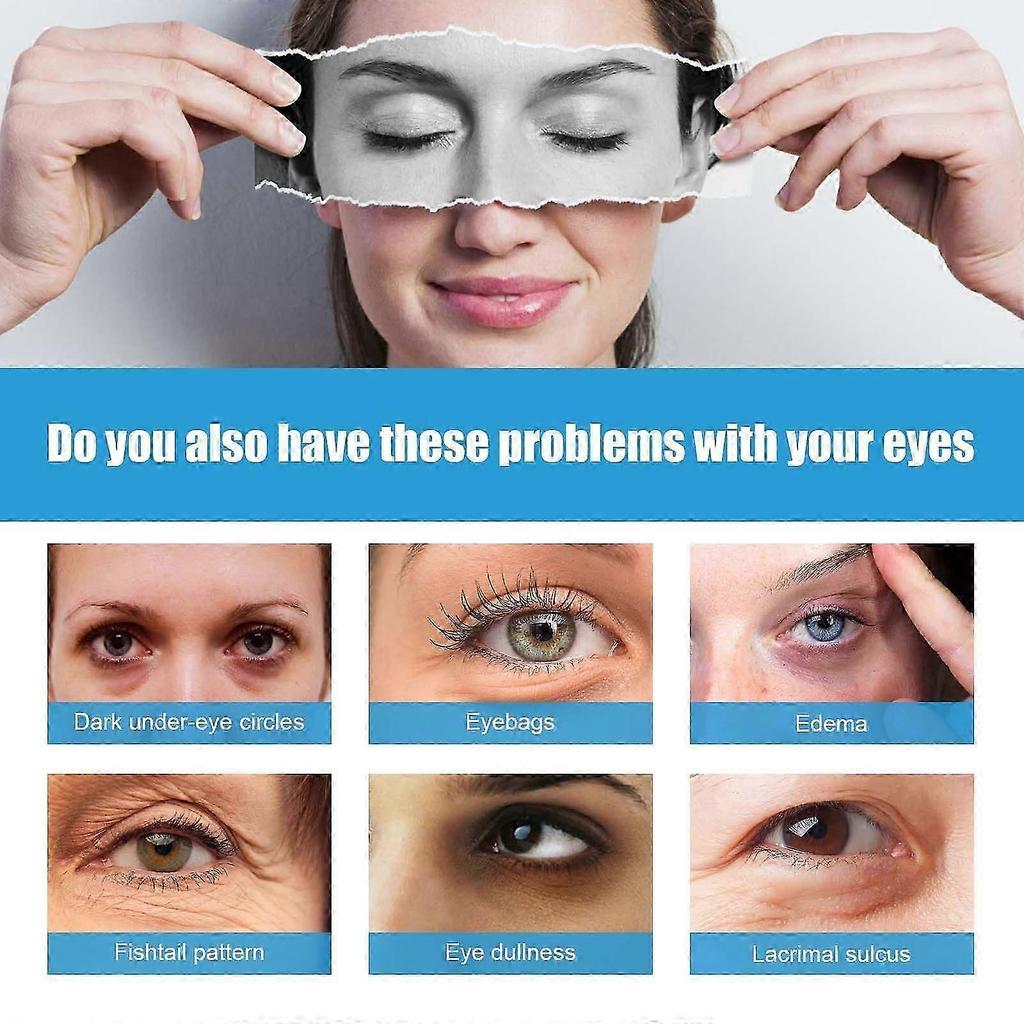 Coffee Extract Eye Cream - Reduces Puffiness, Fine Lines & Dark Circles, Hydrating & Firming Eye Care