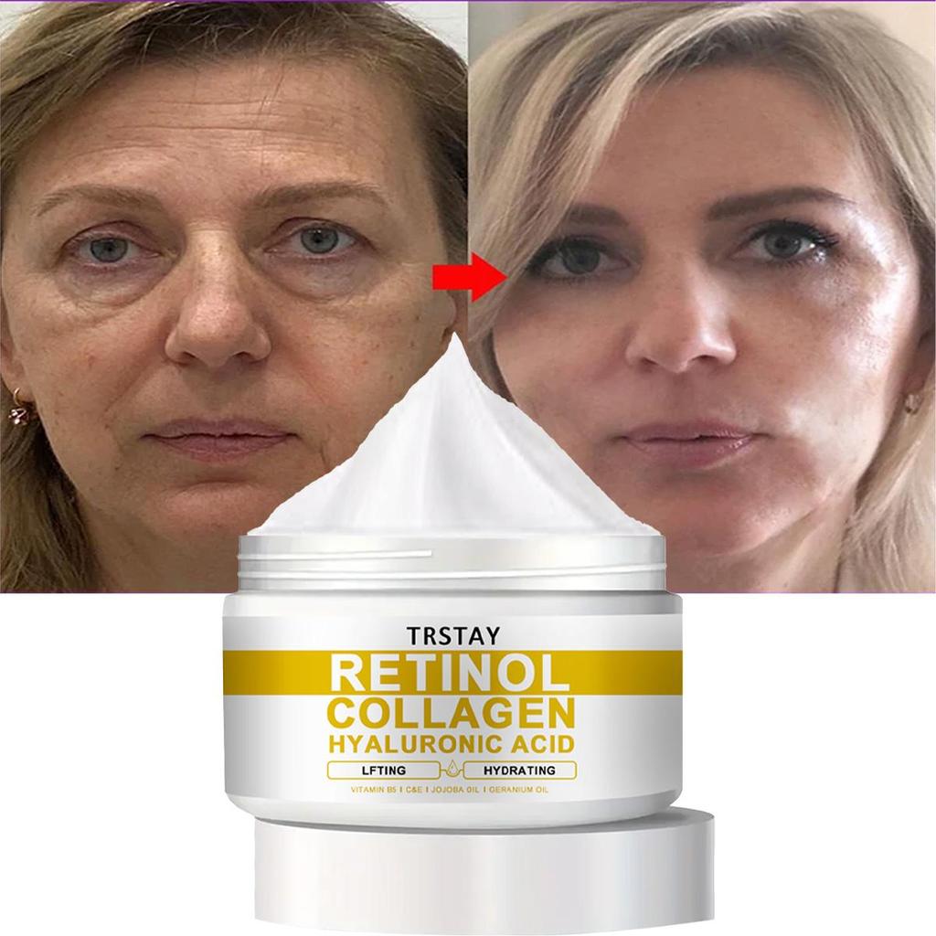 TRSTAY Антивозрастной крем для лица, коллаген, ретинол и гиалуроновая кислота, роскошный крем для кожи вокруг глаз против морщин, предотвращающий появление сухих линий